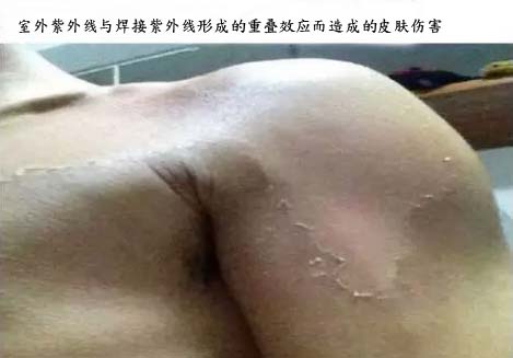 又到伏天！“蓝翔”PPE防紫外线、防静电复合功能安全防护面料为你抵御侵袭